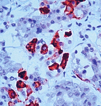 TSH Antibody in Immunohistochemistry (Paraffin) (IHC (P))