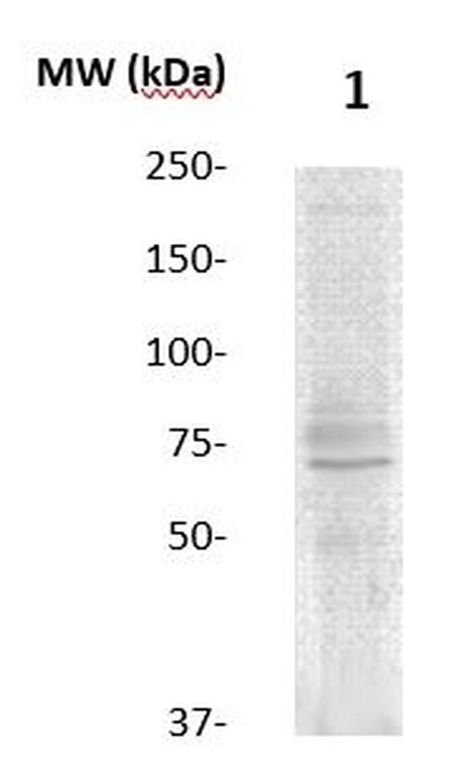 15-Lox-2 Antibody in Western Blot (WB)