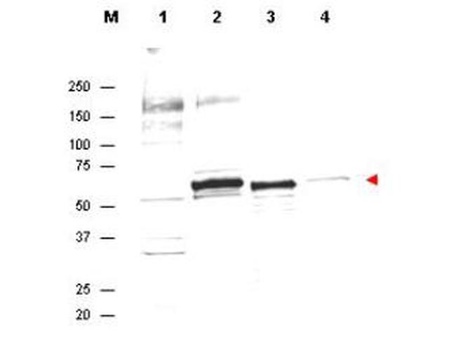 AKT Antibody in Western Blot (WB)