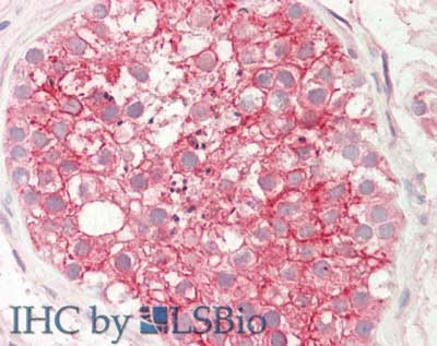 STIM1 Antibody in Immunohistochemistry (Paraffin) (IHC (P))