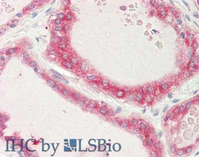 STIM1 Antibody in Immunohistochemistry (Paraffin) (IHC (P))