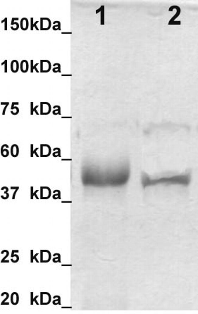 Calumenin Antibody in Western Blot (WB)