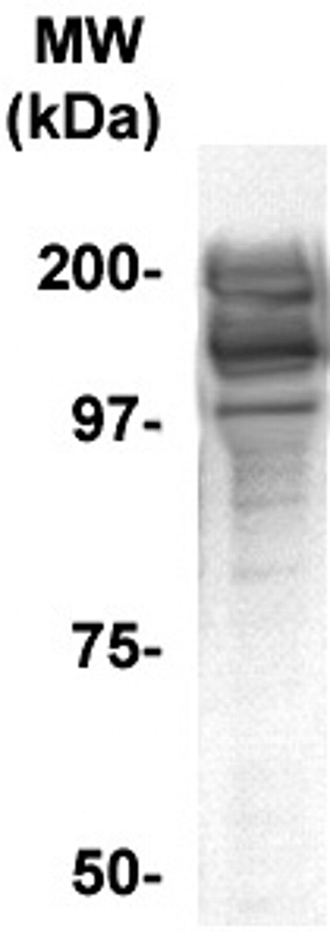 Aggrecan/AGC1 Antibody in Western Blot (WB)