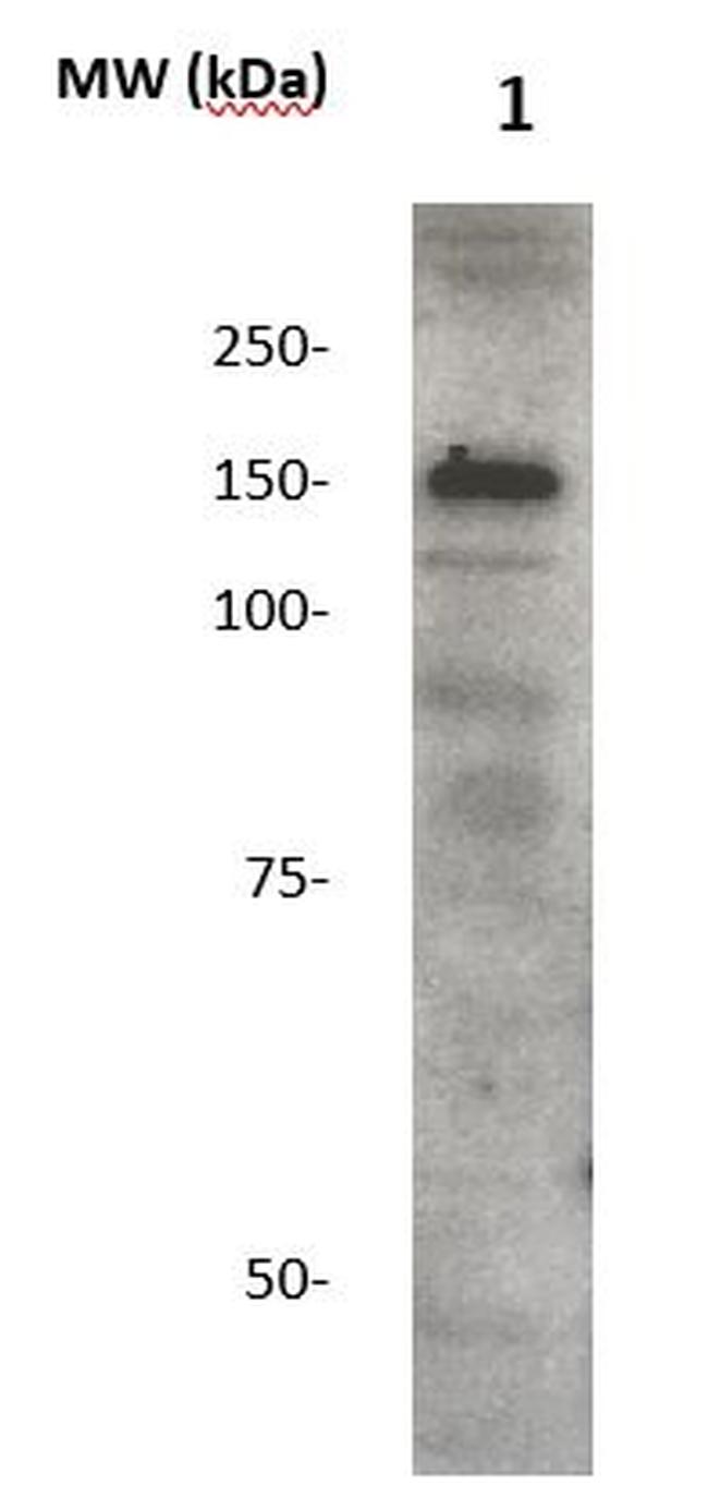 Phospho-IRS2 (Ser1001) Antibody in Western Blot (WB)