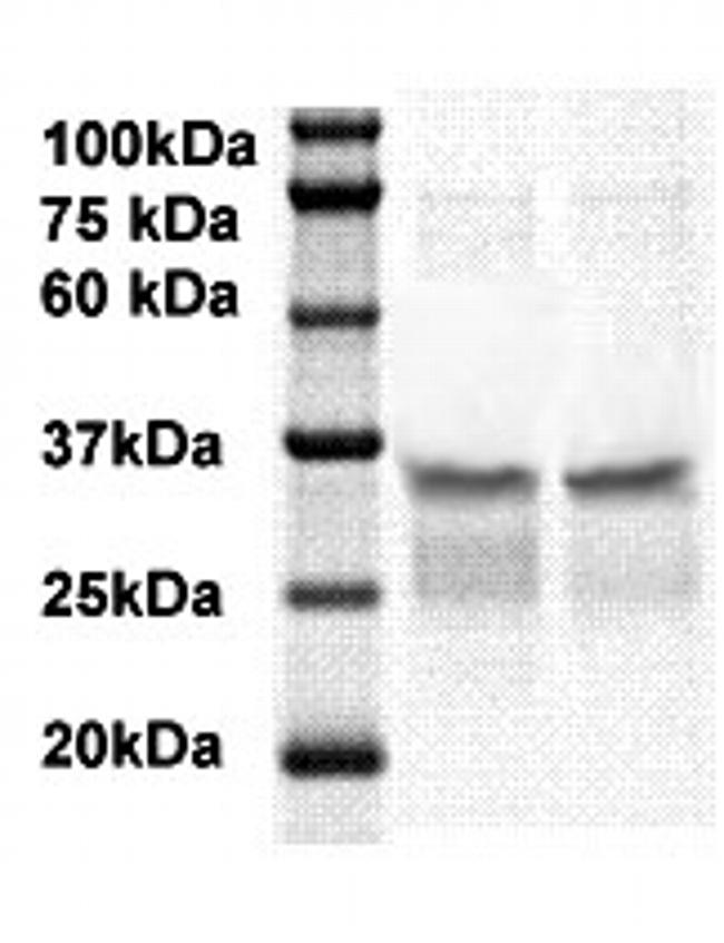 PSA/Kallikrein 3 Antibody in Western Blot (WB)