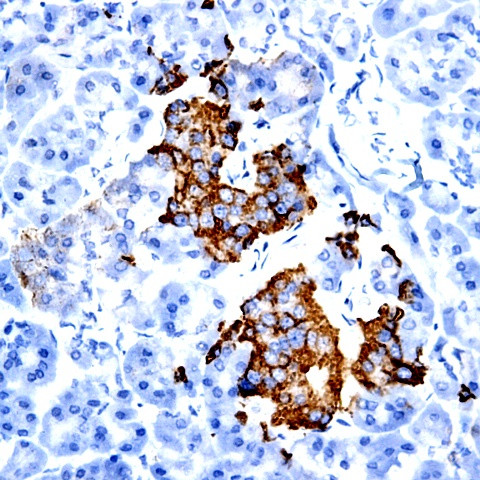 FGF 4 Antibody in Immunohistochemistry (Paraffin) (IHC (P))