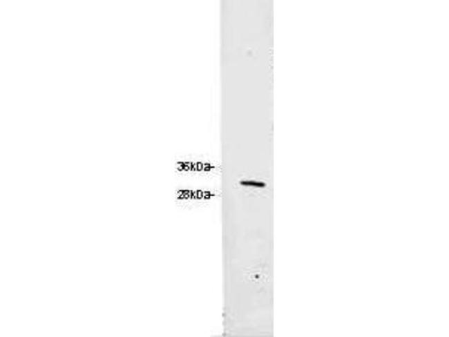 RFP Antibody in Western Blot (WB)