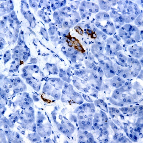 FGF4 Antibody in Immunohistochemistry (Paraffin) (IHC (P))