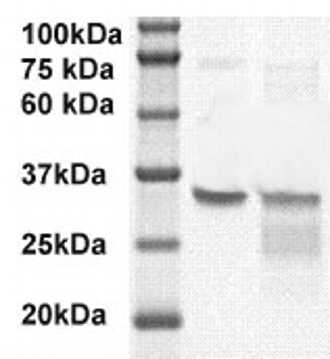 PSA/Kallikrein3 Antibody in Western Blot (WB)