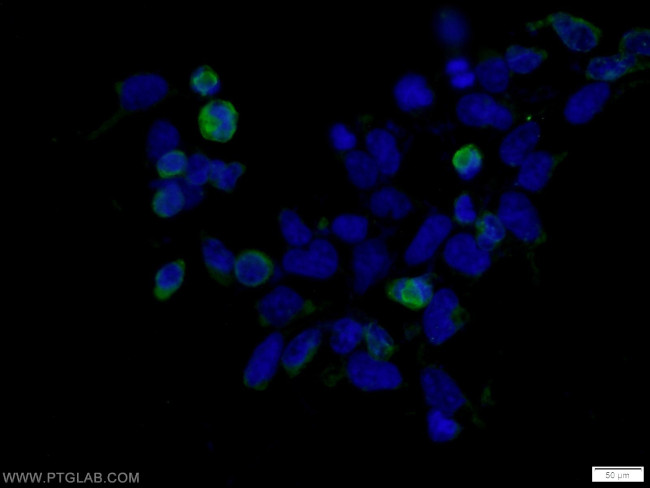 MYC tag Antibody in Immunocytochemistry (ICC/IF)