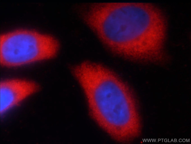 GAPDH Antibody in Immunocytochemistry (ICC/IF)