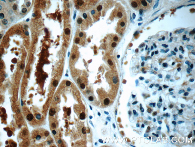 GAPDH Antibody in Immunohistochemistry (Paraffin) (IHC (P))