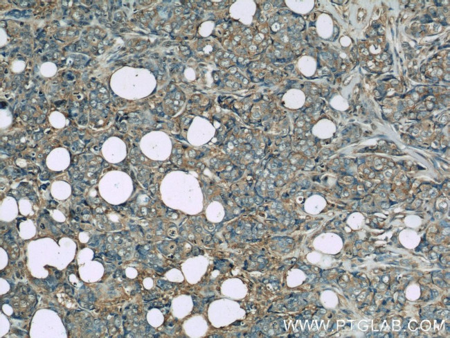 GAPDH Antibody in Immunohistochemistry (Paraffin) (IHC (P))