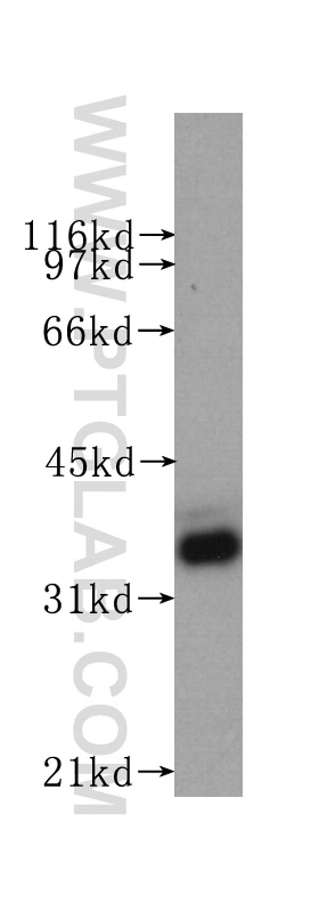 GAPDH Antibody in Western Blot (WB)