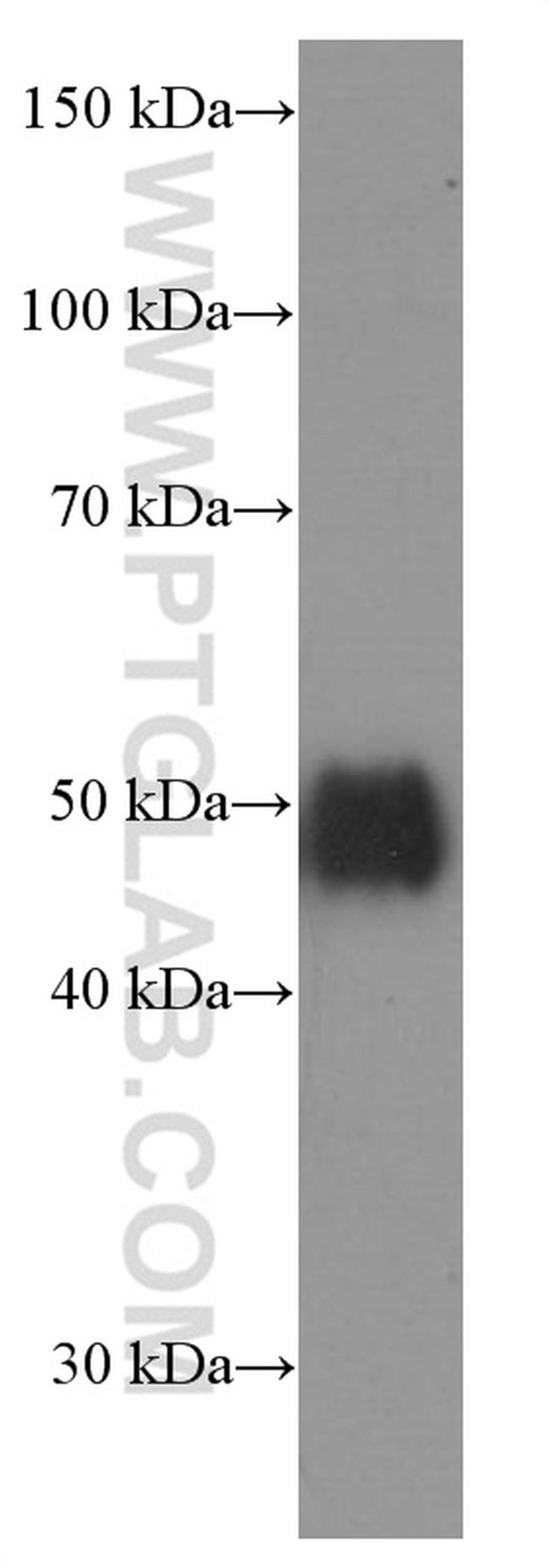 CD2 Antibody in Western Blot (WB)