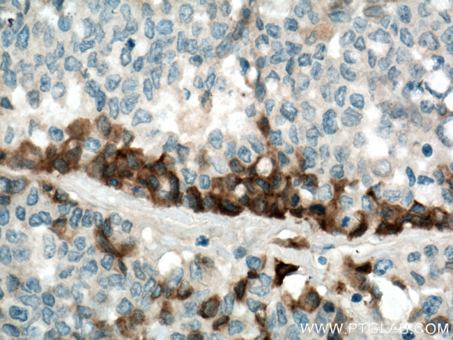 TGFBI / BIGH3 Antibody in Immunohistochemistry (Paraffin) (IHC (P))