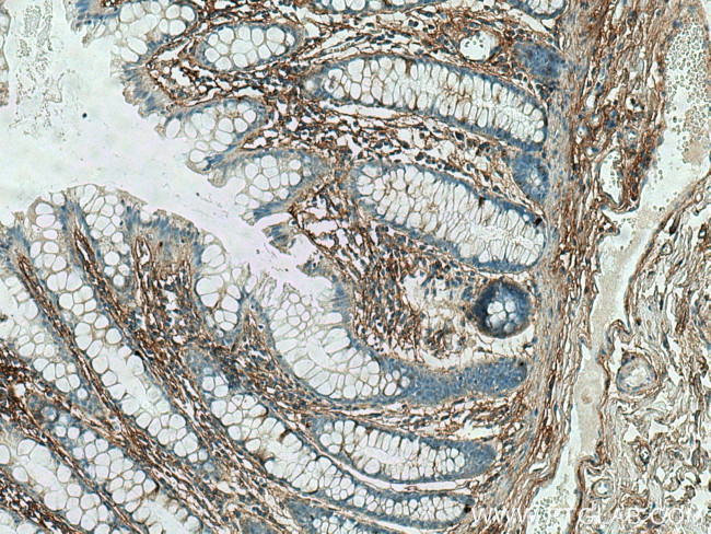 TGFBI / BIGH3 Antibody in Immunohistochemistry (Paraffin) (IHC (P))