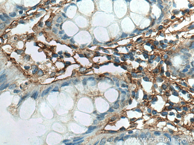 TGFBI / BIGH3 Antibody in Immunohistochemistry (Paraffin) (IHC (P))