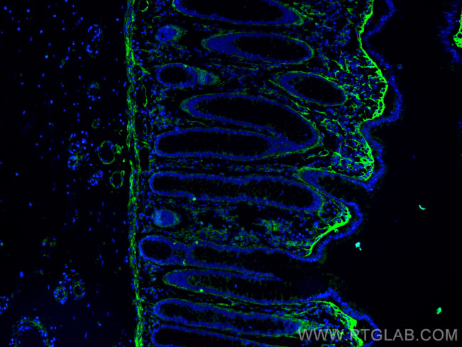 TGFBI / BIGH3 Antibody in Immunohistochemistry (PFA fixed) (IHC (PFA))