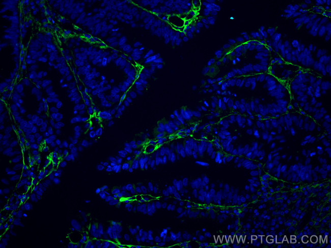 TGFBI / BIGH3 Antibody in Immunohistochemistry (PFA fixed) (IHC (PFA))