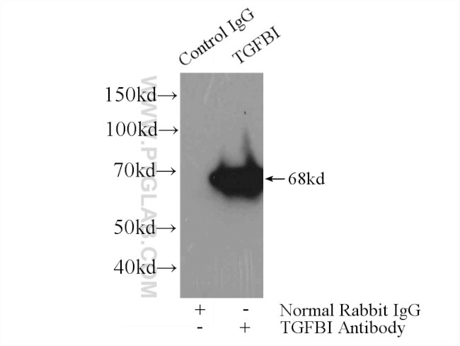 TGFBI / BIGH3 Antibody in Immunoprecipitation (IP)