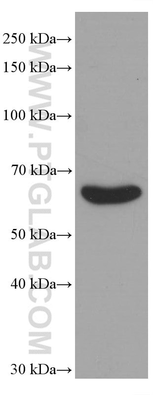 TGFBI / BIGH3 Antibody in Western Blot (WB)