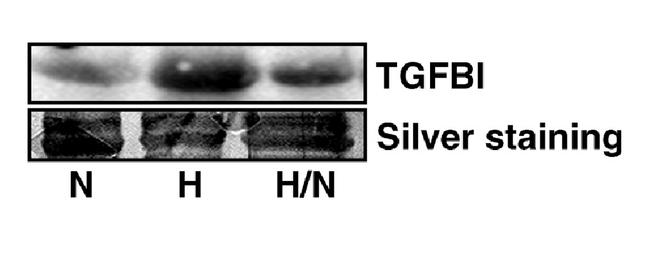 TGFBI / BIGH3 Antibody in Western Blot (WB)