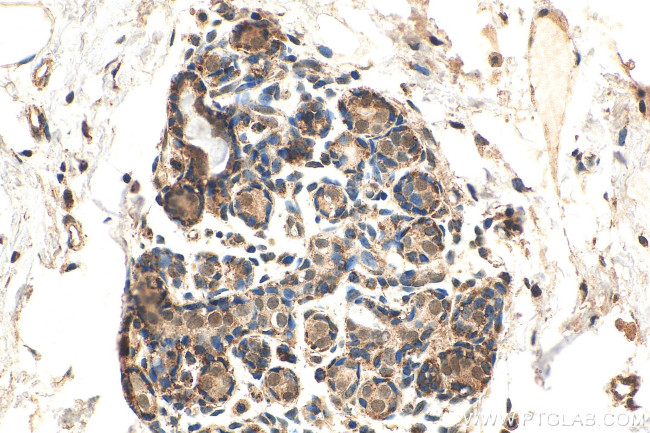 GATA1 Antibody in Immunohistochemistry (Paraffin) (IHC (P))