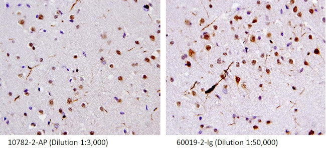 TDP-43 Antibody in Immunohistochemistry (IHC)