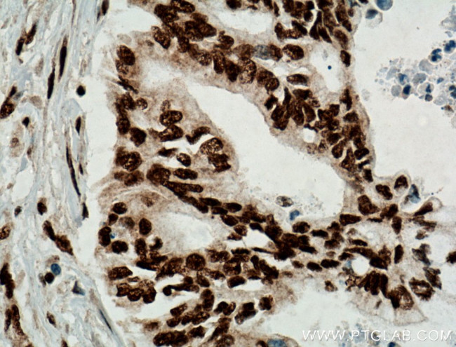 TDP-43 Antibody in Immunohistochemistry (Paraffin) (IHC (P))