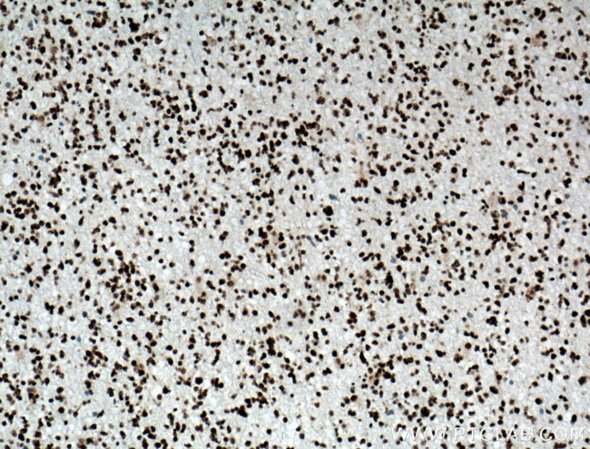 TDP-43 Antibody in Immunohistochemistry (Paraffin) (IHC (P))