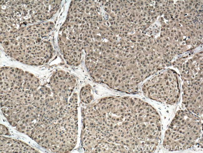 S100A11 Antibody in Immunohistochemistry (Paraffin) (IHC (P))