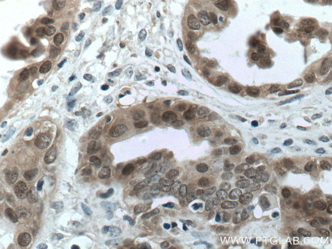 S100A11 Antibody in Immunohistochemistry (Paraffin) (IHC (P))