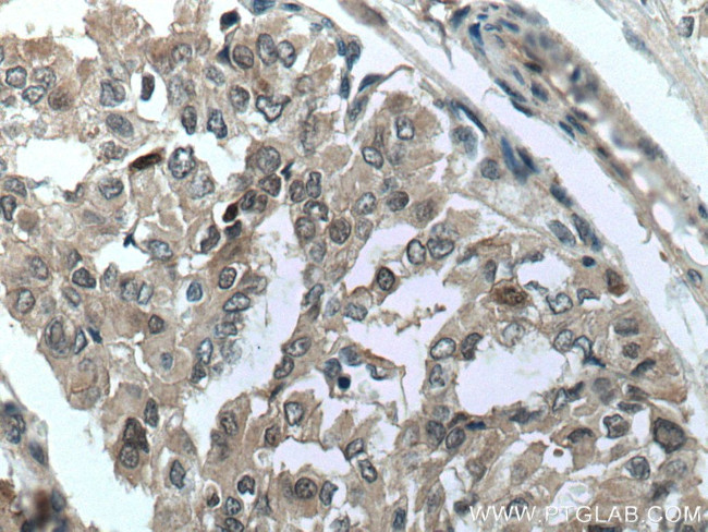 S100A11 Antibody in Immunohistochemistry (Paraffin) (IHC (P))