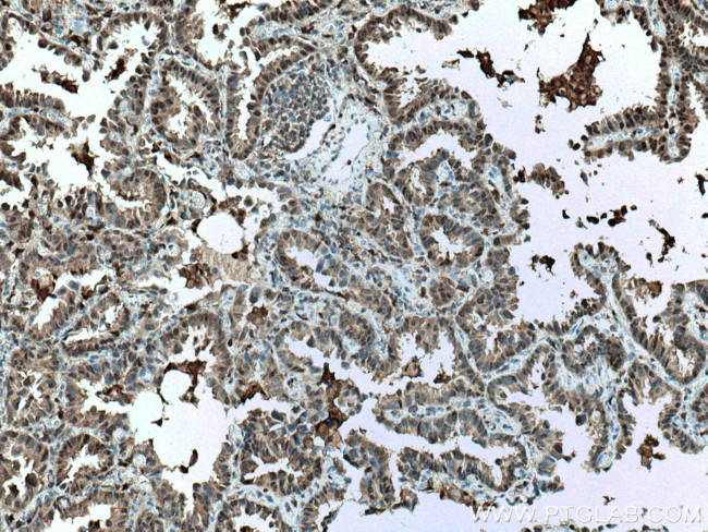 S100A11 Antibody in Immunohistochemistry (Paraffin) (IHC (P))