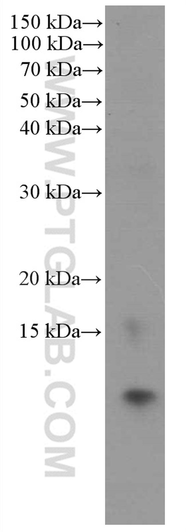 S100A11 Antibody in Western Blot (WB)