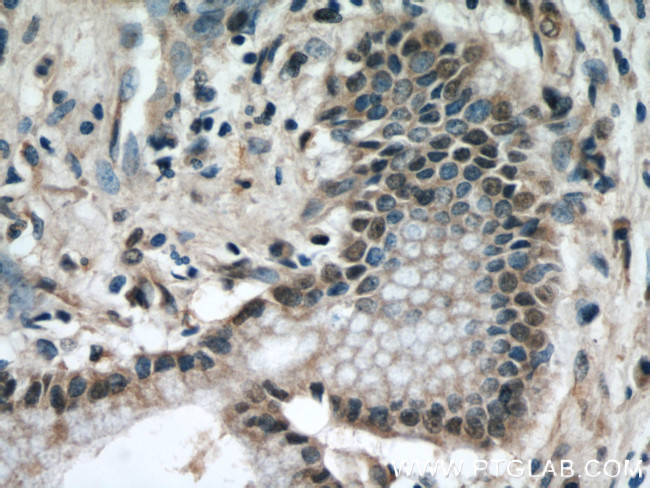 KEAP1 Antibody in Immunohistochemistry (Paraffin) (IHC (P))