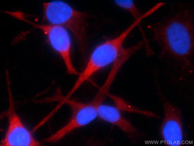 KMO Antibody in Immunocytochemistry (ICC/IF)