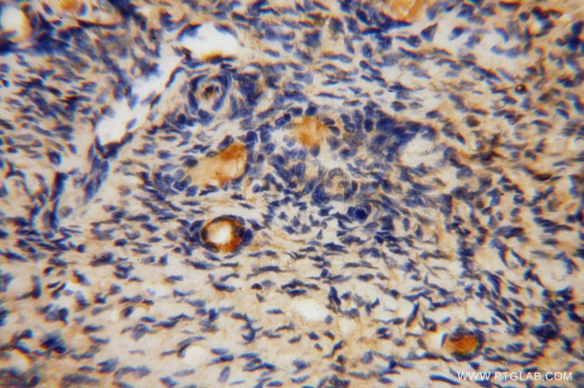 KMO Antibody in Immunohistochemistry (Paraffin) (IHC (P))