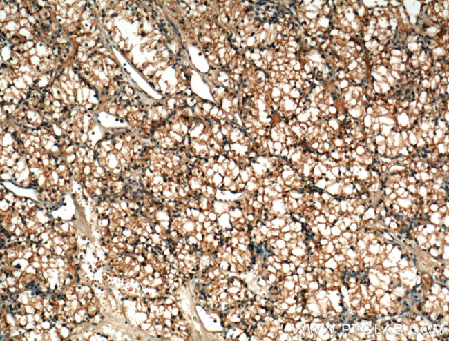 MME/CD10 Antibody in Immunohistochemistry (Paraffin) (IHC (P))