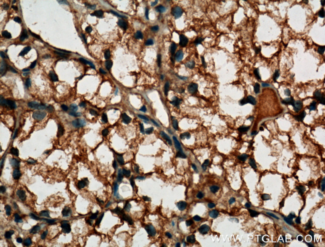 MME/CD10 Antibody in Immunohistochemistry (Paraffin) (IHC (P))