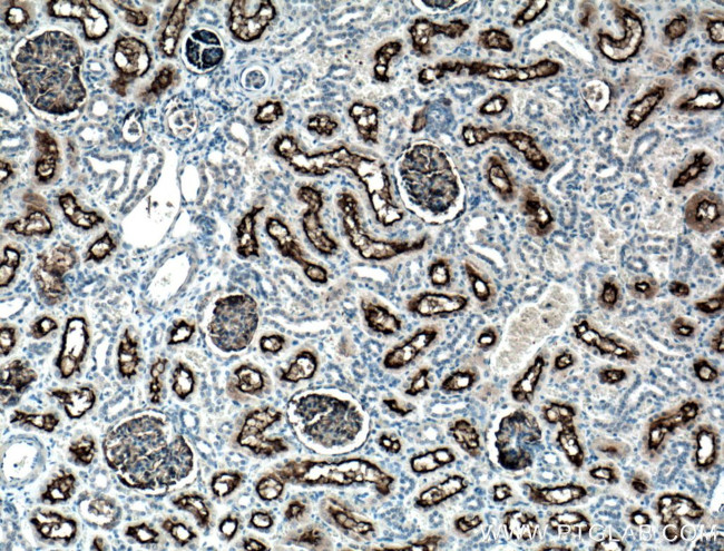 MME/CD10 Antibody in Immunohistochemistry (Paraffin) (IHC (P))