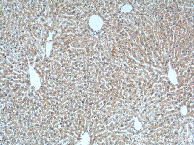 MME/CD10 Antibody in Immunohistochemistry (Paraffin) (IHC (P))