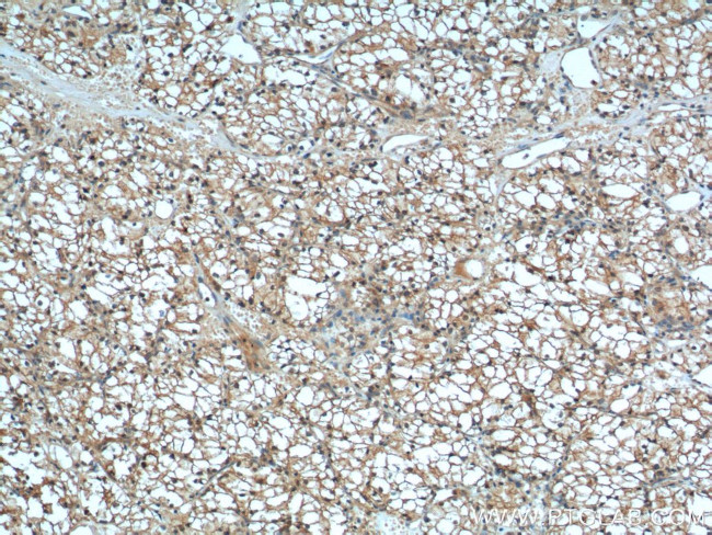 MME/CD10 Antibody in Immunohistochemistry (Paraffin) (IHC (P))