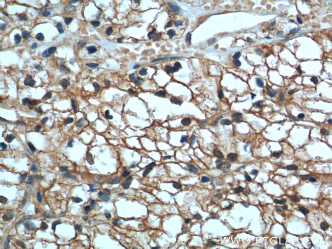 MME/CD10 Antibody in Immunohistochemistry (Paraffin) (IHC (P))