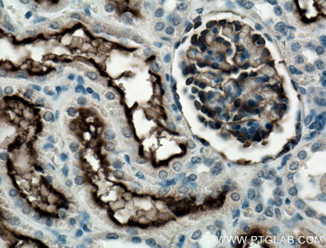 MME/CD10 Antibody in Immunohistochemistry (Paraffin) (IHC (P))