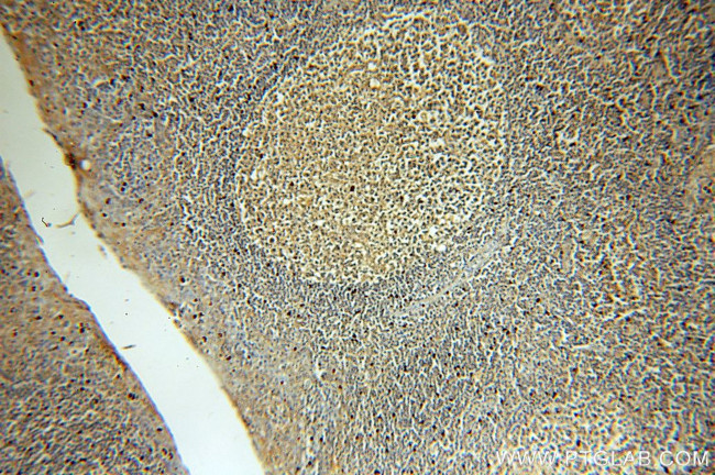 MME/CD10 Antibody in Immunohistochemistry (Paraffin) (IHC (P))