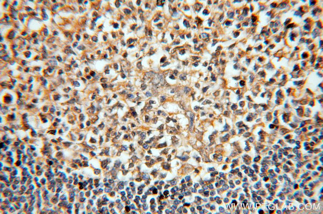 MME/CD10 Antibody in Immunohistochemistry (Paraffin) (IHC (P))