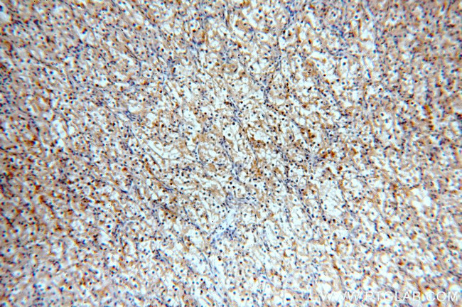 MME/CD10 Antibody in Immunohistochemistry (Paraffin) (IHC (P))