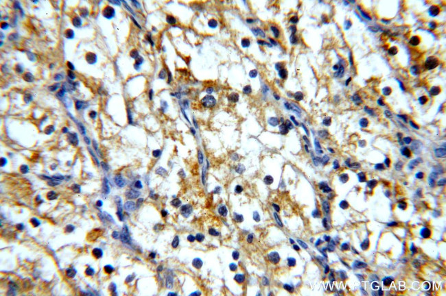 MME/CD10 Antibody in Immunohistochemistry (Paraffin) (IHC (P))